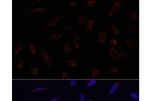Immunofluorescence analysis of U-2 OS cells using ACAT1 Polyclonal Antibody at dilution of 1:100. (ACAT1 antibody)