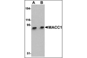 Western blot analysis of MACC1 in mouse liver tissue lysate with this product at (A) 1 and (B) 2 μg/ml. (MACC1 antibody  (Center))