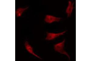 ABIN6272463 staining 293 by IF/ICC. (GTF2IRD1 antibody  (N-Term))
