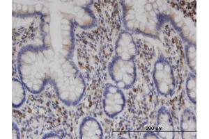 Immunostaining (ISt) image for anti-Clathrin Interactor 1 (CLINT1) (AA 161-261) antibody (ABIN523164)