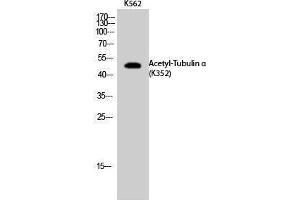 Western Blotting (WB) image for anti-alpha Tubulin (TUBA1) (acLys352) antibody (ABIN6285483) (alpha Tubulin antibody  (acLys352))