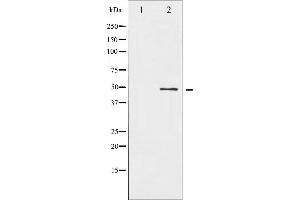 Western blot analysis of ATF2 expression in HeLa whole cell lysates,The lane on the left is treated with the antigen-specific peptide. (ATF2 antibody  (N-Term))
