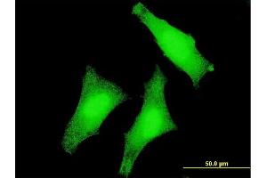 Immunofluorescence of monoclonal antibody to USP3 on HeLa cell. (USP3 antibody  (AA 421-520))