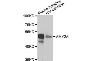 Western blot analysis of extracts of various cell lines, using AMY2A antibody (ABIN5975245) at 1/1000 dilution. (AMY2A antibody)