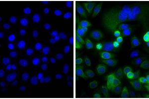 Human pancreatic carcinoma cell line MIA PaCa-2 was stained with Mouse Anti-Cytokeratin 18-UNLB and DAPI. (Goat anti-Mouse IgG (Heavy & Light Chain) Antibody (FITC) - Preadsorbed)