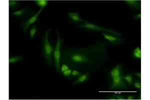 Immunofluorescence of monoclonal antibody to PDE6D on HeLa cell. (PDE6D antibody  (AA 1-150))