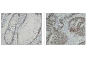 Immunohistochemistry (IHC) image for anti-Heterogeneous Nuclear Ribonucleoprotein K (HNRNPK) (C-Term) antibody (ABIN264512) (HNRNPK antibody  (C-Term))