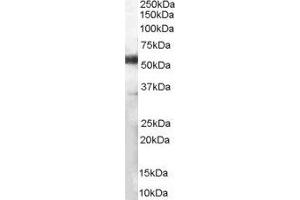 ABIN2561667 (1µg/ml) staining of Human Lymph Node lysate (35µg protein in RIPA buffer). (CD14 antibody  (Internal Region))