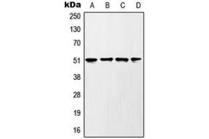 Western blot analysis of GSK3 alpha (pS21) expression in HEK293T UV-treated (A), mouse liver (B), rat liver (C), PC12 H2O2-treated (D) whole cell lysates. (GSK3 alpha antibody  (N-Term, pSer21))