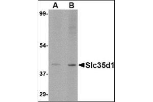 Western blot analysis of Slc35D1 inA-20 lysate with Slc35D1 antibody at (A) 1 and (B) 2 µg/ml.