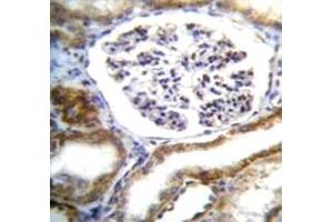 Immunohistochemistry (IHC) image for anti-Intraflagellar Transport 88 Homolog (IFT88) (AA 791-820) antibody (ABIN3028768)