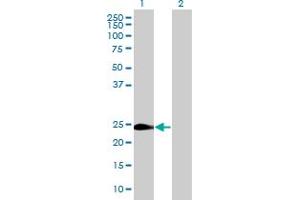 Western Blot analysis of WISP2 expression in transfected 293T cell line by WISP2 MaxPab polyclonal antibody. (WISP2 antibody  (AA 1-250))