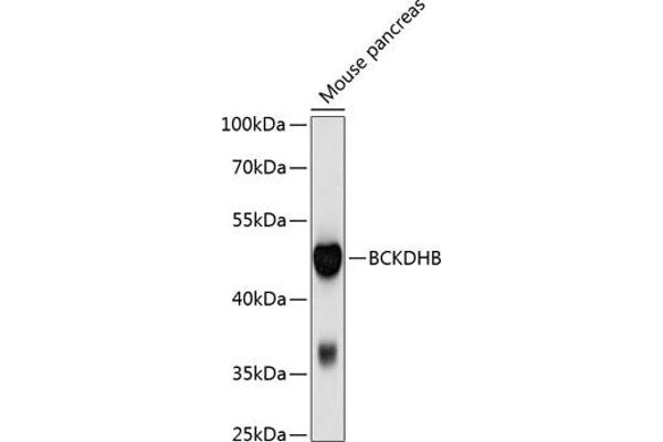 BCKDHB 抗体  (AA 183-392)