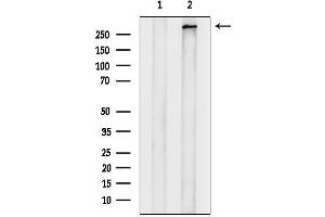 anti-ATP-Binding Cassette, Sub-Family A (ABC1), Member 12 (ABCA12) (C-Term) antibody
