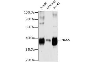 Western blot analysis of extracts of various cell lines, using NANS antibody (ABIN6291679) at 1:3000 dilution. (NANS antibody)
