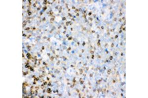 Anti- IL16 antibody, IHC(P) IHC(P): Human Tonsil Tissue (IL16 antibody  (AA 1212-1332))