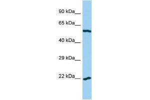 Host: Rabbit Target Name: MRPL32 Sample Type: U937 Whole Cell lysates Antibody Dilution: 1. (MRPL32 antibody  (C-Term))