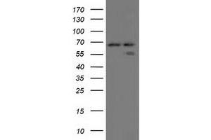 HEK293T cells were transfected with the pCMV6-ENTRY control (Left lane) or pCMV6-ENTRY AFP (Right lane) cDNA for 48 hrs and lysed. (alpha Fetoprotein antibody)