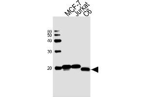 Sample Tissue/Cells lysates probed with antibodyname Monoclonal Antibody, unconjugated (bsm-51413M) at 1:1000 overnight at 4°C followed by a conjugated secondary antibody for 60 minutes at Room Temperature. (NME1 antibody)
