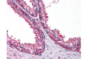 Anti-PTER antibody IHC of human prostate.