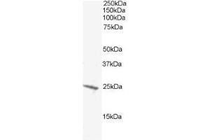 Image no. 1 for anti-BCL2-Antagonist/killer 1 (BAK1) (N-Term) antibody (ABIN374174) (BAK1 antibody  (N-Term))