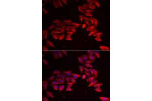 Immunofluorescence analysis of HeLa cell using SFRP4 antibody.