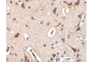 Immunohistochemistry of ILPIP in human brain tissue with ILPIP antibody at 10 μg/ml. (STRADB antibody  (Intermediate Domain))
