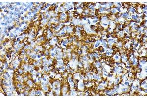 Immunohistochemistry of paraffin-embedded Human tonsil using CSNK1A1 Polyclonal Antibody at dilution of 1:100 (40x lens). (CSNK1A1 antibody)