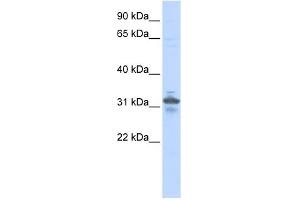 WB Suggested Anti-RPIA Antibody Titration: 0. (Ribose 5-Phosphate Isomerase A (RPIA) (N-Term) antibody)
