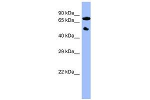 WB Suggested Anti-CYP11B2 Antibody Titration:  0. (CYP11B2 antibody  (Middle Region))