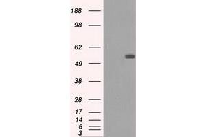 Image no. 2 for anti-Fumarate Hydratase (FH) antibody (ABIN1498269) (FH antibody)