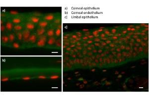 Immunofluorescence (IF) image for anti-Zinc Finger E-Box Binding Homeobox 1 (ZEB1) (N-Term) antibody (ABIN2779631)