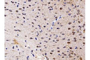 IHC analysis of FKBP135/FKBP15 using anti-FKBP135/FKBP15 antibody (ABIN7600397). (FKBP15 antibody  (AA 19-1210))
