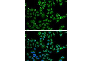 Immunofluorescence analysis of U2OS cell using LMNB2 antibody. (Lamin B2 antibody)