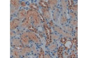 #VALUE! (PTPN14 antibody  (AA 1-188))