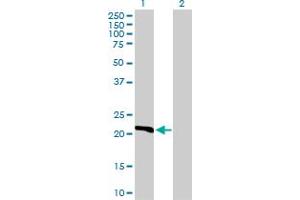 Western Blot analysis of DHFR expression in transfected 293T cell line by DHFR MaxPab polyclonal antibody. (Dihydrofolate Reductase antibody  (AA 1-187))