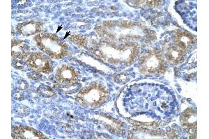 CDK7 antibody was used for immunohistochemistry at a concentration of 4-8 ug/ml to stain Epithelial cells of renal tubule (lndicated with Arrows] in Human Kidney. (CDK7 antibody  (C-Term))