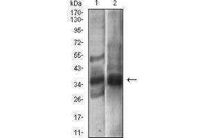 Western blot analysis using EPCAM mouse mAb against A431 (1), MCF-7 (2) cell lysate. (EpCAM antibody  (AA 24-265))