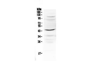 Western blot analysis of IL12B using anti-IL12B antibody . (IL12B antibody  (AA 23-250))
