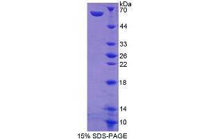 Image no. 1 for Amphiregulin (AREG) (AA 27-247) protein (His tag,GST tag) (ABIN3209857)