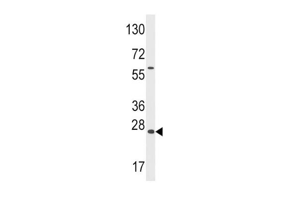 GADD45A antibody  (N-Term)