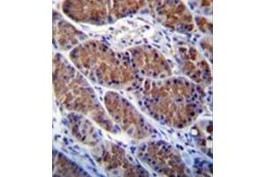 Immunohistochemistry analysis in formalin fixed and paraffin embedded human stomach tissue reacted with Otopetrin-1 Antibody (Center) followed which was peroxidase conjugated to the secondary antibody and followed by DAB staining. (Otopetrin 1 antibody  (Middle Region))