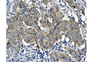 IHC analysis of RENT1/hUPF1 using anti-RENT1/hUPF1 antibody (ABIN7602979). (RENT1/UPF1 antibody  (Middle Region))