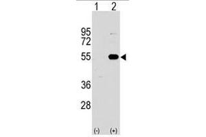 Image no. 2 for anti-Sprouty-Related, EVH1 Domain Containing 1 (SPRED1) (N-Term) antibody (ABIN356947) (SPRED1 antibody  (N-Term))