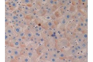 Detection of AZU in Human Liver Tissue using Polyclonal Antibody to Azurocidin (AZU) (Azurocidin antibody  (AA 23-247))