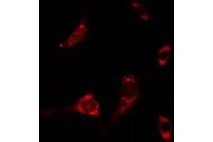 ABIN6275471 staining A549 cells by IF/ICC. (RAB6A antibody  (Internal Region))