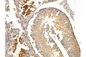 ABIN6264142 and ABIN6266623 at 1/100 staining Mouse testis tissue by IHC-P. (Peripherin antibody  (C-Term))