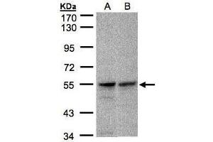WB Image Sample(30 ug whole cell lysate) A:A431, B:Raji , 7. (FOXRED1 antibody)