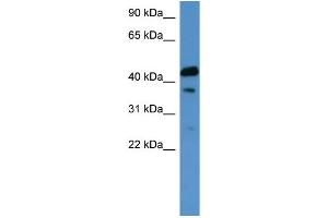 WB Suggested Anti-CALCR Antibody Titration: 0.