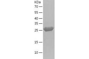 Western Blotting (WB) image for Glucosamine-6-Phosphate Deaminase 1 (GNPDA1) (AA 1-289) protein (His tag) (ABIN7123103) (GNPDA1 Protein (AA 1-289) (His tag))